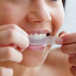 Sbiancamento dentale  – Trattamenti fai da te