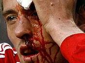 Sfigurina Peter Crouch