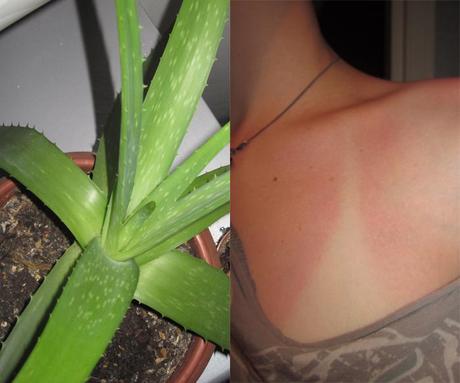 Aloe Vera contro le bruciature