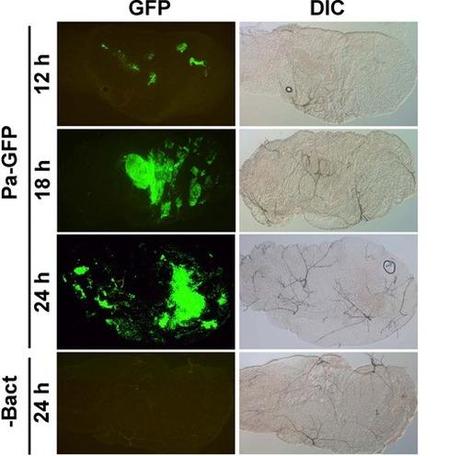 Batteri OGM per combattere la malaria