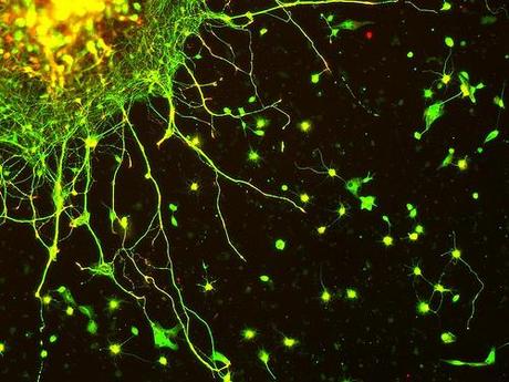 Neuroni ricreati a partire da cellule staminali del cordone ombelicale