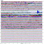 Seismogram 2  Tungurahua volcano, Ecuador