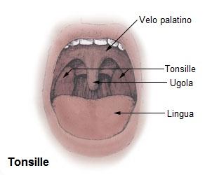 Preparativi per salutare le mie tonsilline cattive