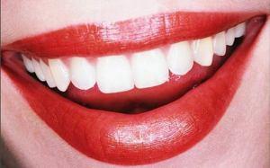 Denti bianchi: i rimedi naturali per un sorriso perfetto