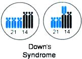 Esercizi di genetica: sindrome di Down, un approfondimento