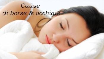 Borse e occhiaie 2 Borse e occhiaie: i miei segreti per combatterle
