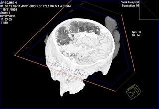 Confermato cervello ben conservato vecchio di oltre 2.500 anni