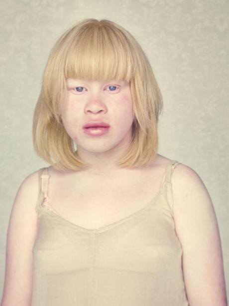 Albinos: gli angeli caduti di Gustavo Lacerda