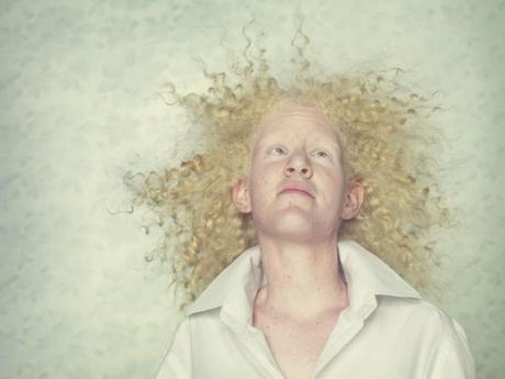 Albinos: gli angeli caduti di Gustavo Lacerda