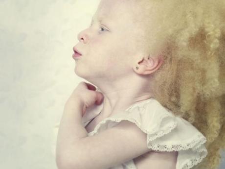 Albinos: gli angeli caduti di Gustavo Lacerda