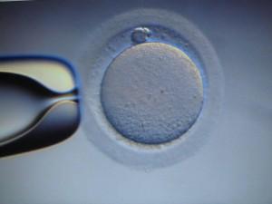 Legge 40 sulla procreazione medicalmente assistita: possibili cambiamenti?