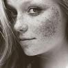 freckles014