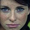 freckles007