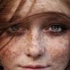 freckles005