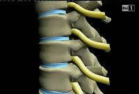 Problemi alla spina dorsale e mal di schiena (SuperQuark)