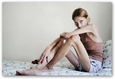 VOGUE ITALIA fa una petizione contro i siti e i blog PRO-ANORESSIA.