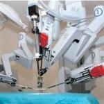 robot chirurgico cancro alla prostata 