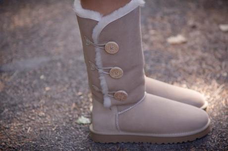 What? UGG In summer? Yes!