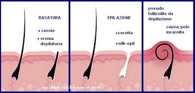 Come prevenire la follicolite da depilazione ?