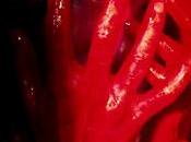 True Blood