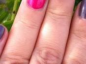 L'unghia maritata