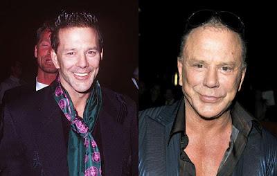 Le star prima e dopo il chirurgo: Mickey Rourke