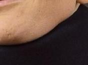 Legge assicurationem. Monti “frega” anche risarcimenti danni rachide cervicale