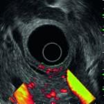 ultrasonografia ecografia 