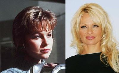 Le star prima e dopo il chirurgo: Pamela Anderson