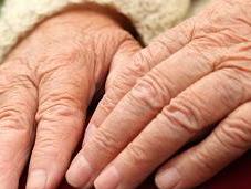 L’invecchiamento patologico: malattia Alzheimer
