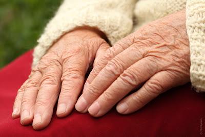 L’invecchiamento patologico: la malattia di Alzheimer