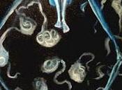 Parasite