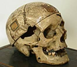 Ancora polemiche sul teschio di Villella studiato da Lombroso