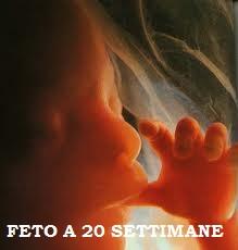 Aborto: il diritto italiano è incoerente, ma ritiene l’embrione una “persona”