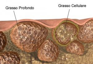 Rimedi e Precauzioni per Scacciare i Sintomi della Cellulite