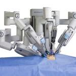 Robot Da Vinci prostatectomia robotica 