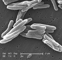 Fiji rischia un epidemia di tubercolosi Il battere della Tubercolosi