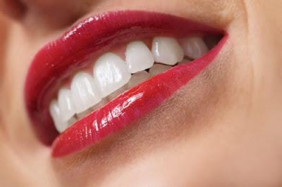 Un bel sorriso con i consigli di SimplyNabiky e Invisalign