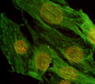 Deficit di zolfo, metabolismo del glucosio, sindrome metabolica ed arteriosclerosi