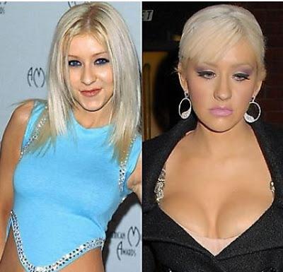 Le star prima e dopo il chirurgo: Christina Aguilera