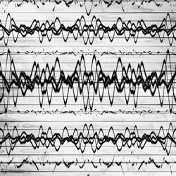 Epilessia e disbiosi (passando per i vaccini e le radiazioni del telefonino)