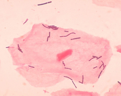 La cellula procariote