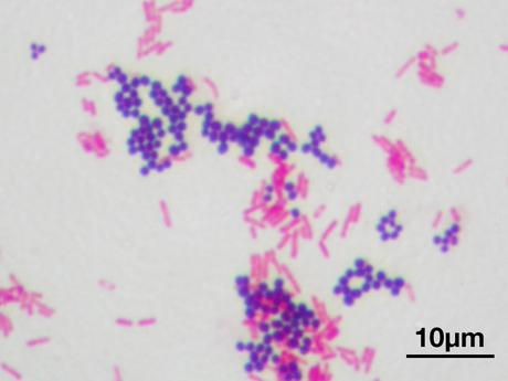 La cellula procariote