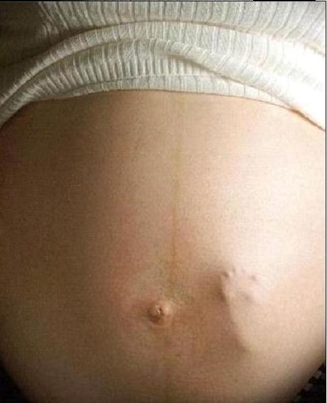 Donna incinta senza permesso di soggiorno 