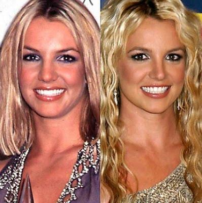 Le star prima e dopo il chirurgo: Britney Spears