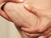 Cellulite? combatte tavola