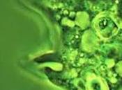 ILDV: Video Amoeba.