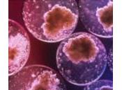 Tumore all’utero, meno rischio? dice proteina