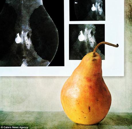 Baby pears: This fruit appears to be looking at neonatal scans of a pregnant pear 