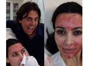 Kardashian, viso coperto sangue: nuovo trattamento pelle